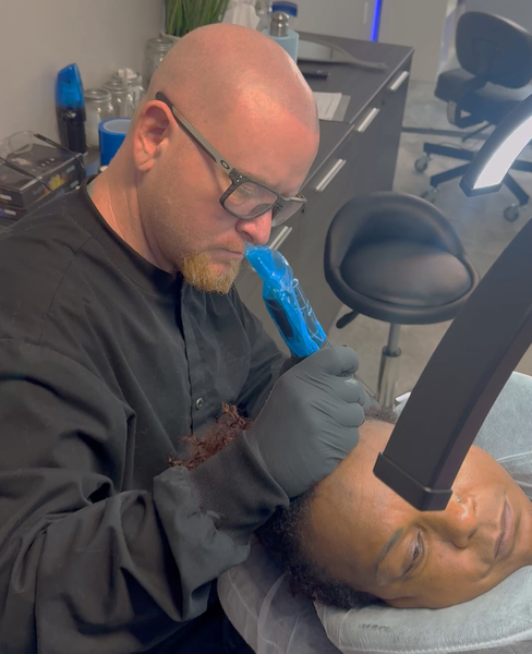 Cover photo of Ultra Scalp Micropigmentation